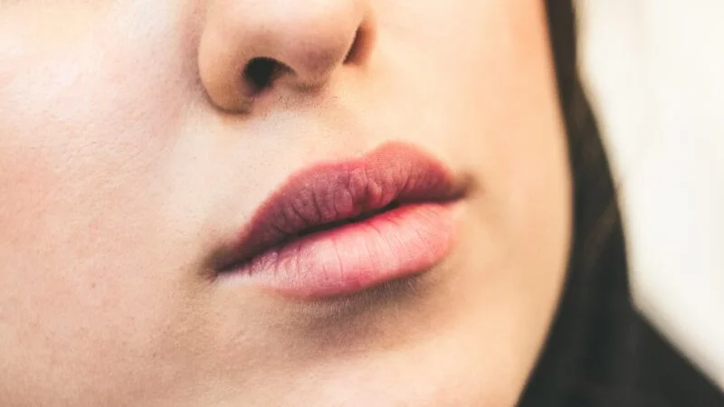 Dudak çatlakları nasıl iyileştirilir - hızlı yöntemler
